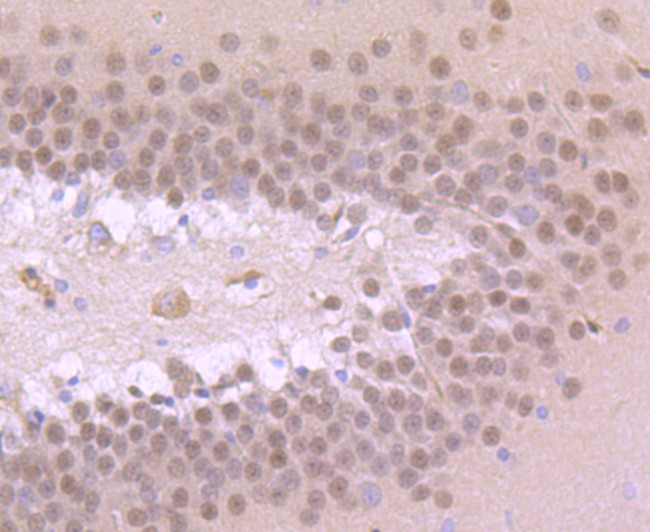 TBR1 Antibody in Immunohistochemistry (Paraffin) (IHC (P))