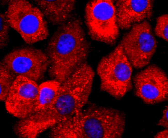 SERCA2 ATPase Antibody in Immunocytochemistry (ICC/IF)