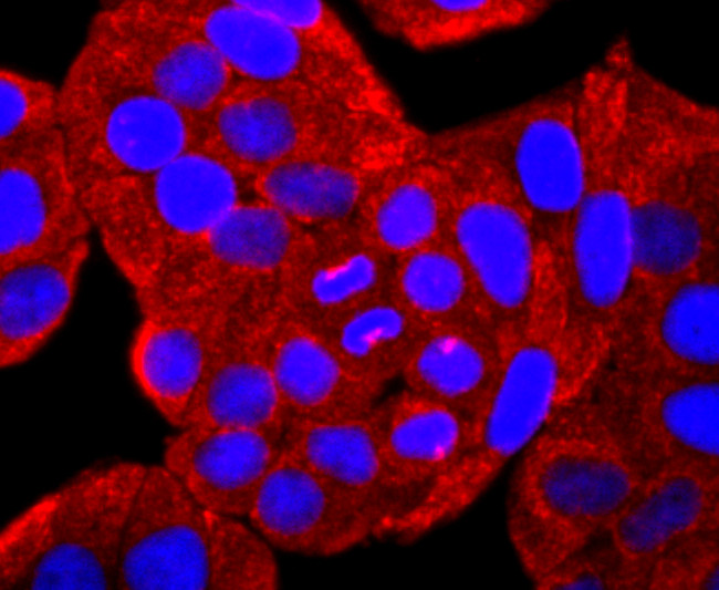 SERCA2 ATPase Antibody in Immunocytochemistry (ICC/IF)