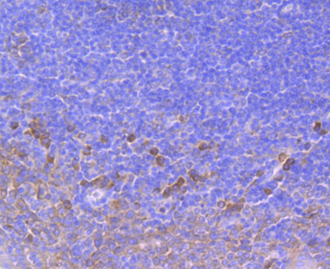 SERCA2 ATPase Antibody in Immunohistochemistry (Paraffin) (IHC (P))