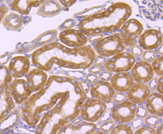 SERCA2 ATPase Antibody in Immunohistochemistry (Paraffin) (IHC (P))