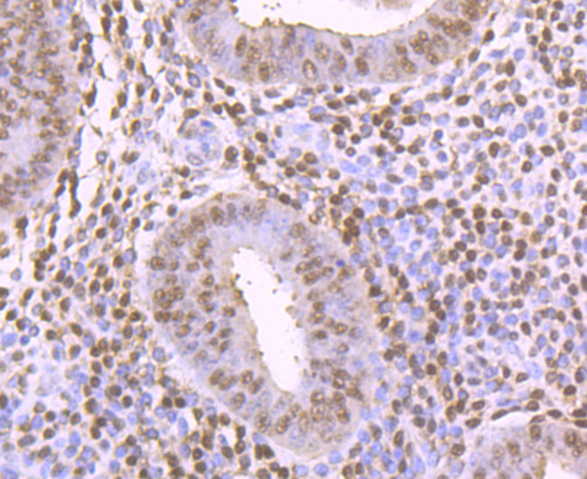 Thioredoxin 1 Antibody in Immunohistochemistry (Paraffin) (IHC (P))