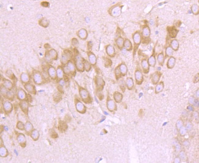 CHOP Antibody in Immunohistochemistry (Paraffin) (IHC (P))