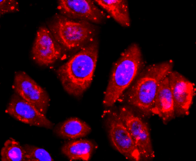 ADAM17 Antibody in Immunocytochemistry (ICC/IF)