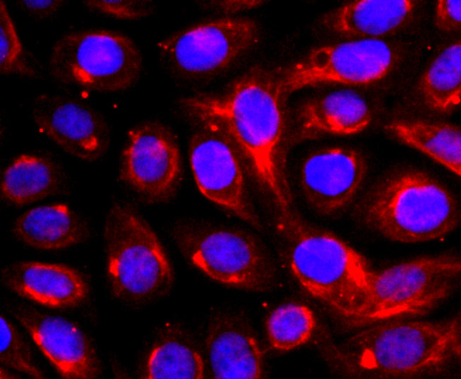 ADAM17 Antibody in Immunocytochemistry (ICC/IF)