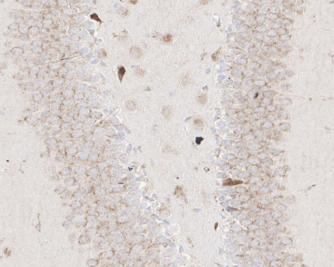 ADAM17 Antibody in Immunohistochemistry (Paraffin) (IHC (P))