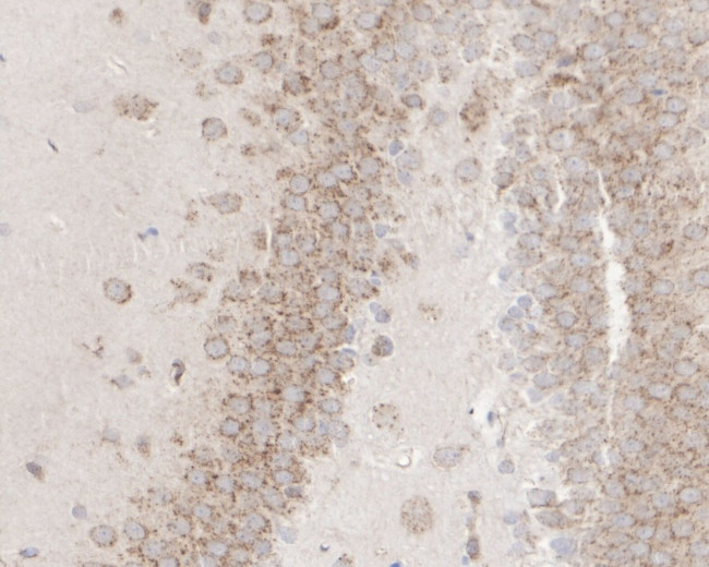 ADAM17 Antibody in Immunohistochemistry (Paraffin) (IHC (P))