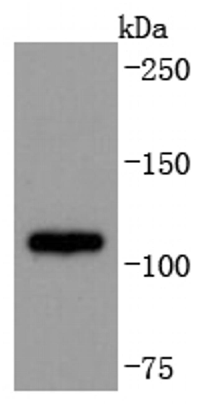 ADAM17 Antibody in Western Blot (WB)