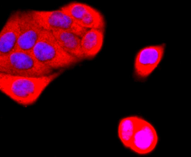 Ub-K63 Antibody in Immunocytochemistry (ICC/IF)