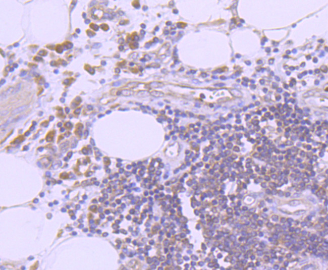 Ub-K63 Antibody in Immunohistochemistry (Paraffin) (IHC (P))