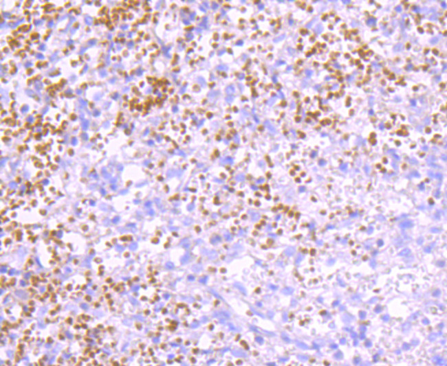 Ub-K63 Antibody in Immunohistochemistry (Paraffin) (IHC (P))