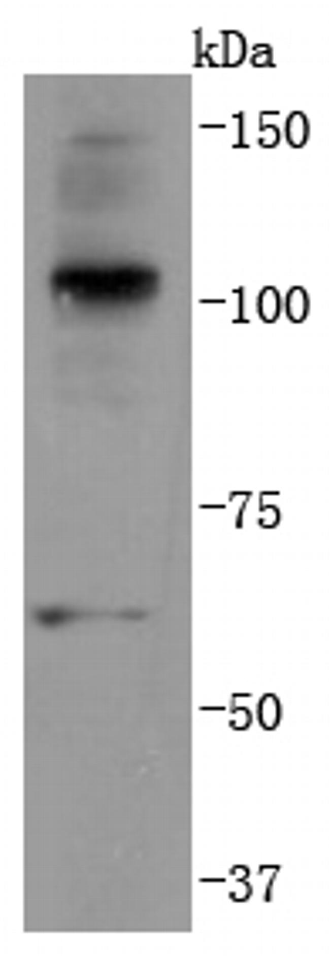 Ub-K63 Antibody in Western Blot (WB)