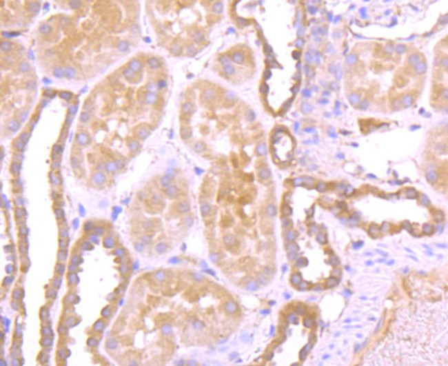 GC Antibody in Immunohistochemistry (Paraffin) (IHC (P))