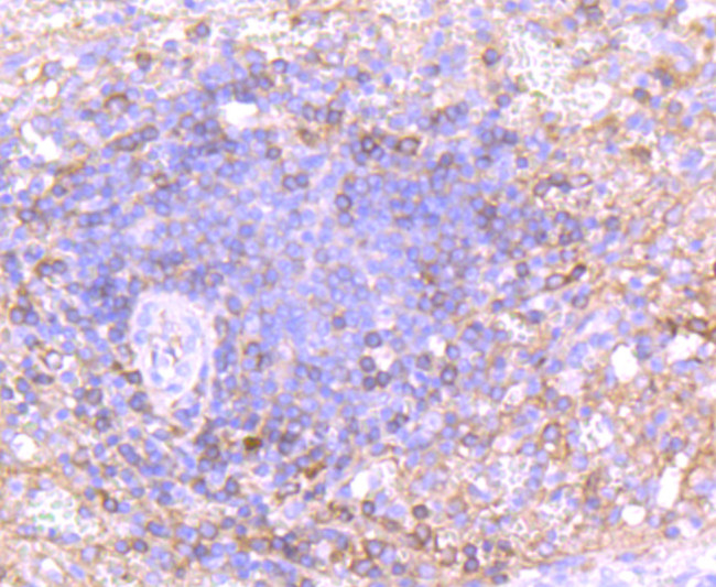 Human IgA Antibody in Immunohistochemistry (Paraffin) (IHC (P))