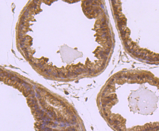 Laminin beta-1 Antibody in Immunohistochemistry (Paraffin) (IHC (P))