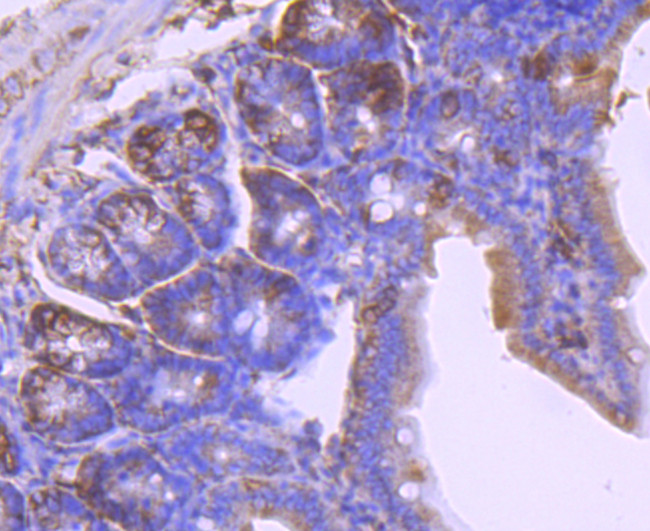 Laminin beta-1 Antibody in Immunohistochemistry (Paraffin) (IHC (P))