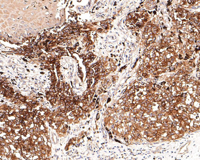 Neural/Glial Antigen 2 (NG2) Antibody in Immunohistochemistry (Paraffin) (IHC (P))