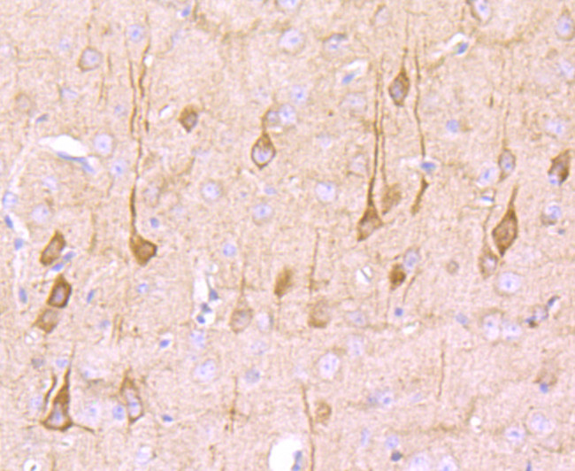 Neural/Glial Antigen 2 (NG2) Antibody in Immunohistochemistry (Paraffin) (IHC (P))