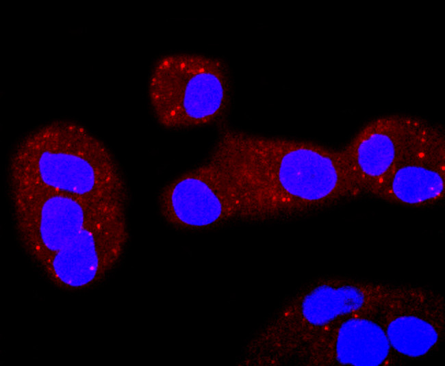 ERCC1 Antibody in Immunocytochemistry (ICC/IF)