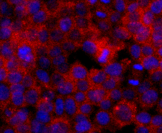 ERCC1 Antibody in Immunocytochemistry (ICC/IF)