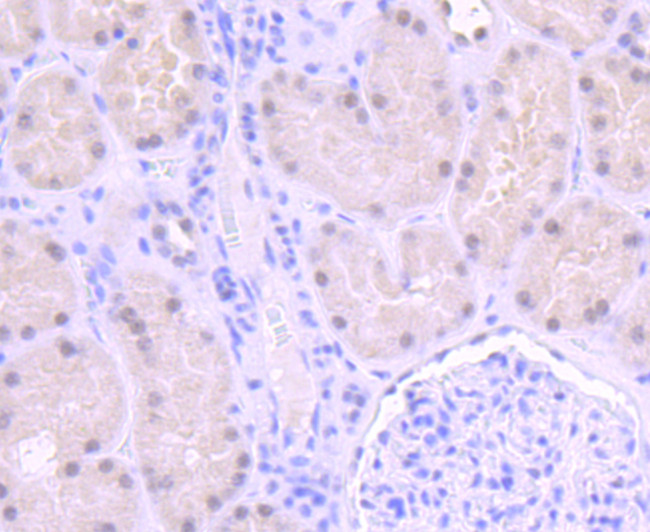 ERCC1 Antibody in Immunohistochemistry (Paraffin) (IHC (P))