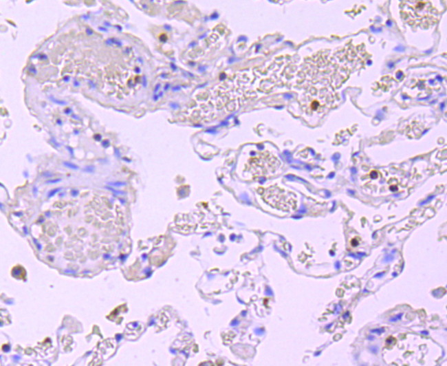 Myeloperoxidase Antibody in Immunohistochemistry (Paraffin) (IHC (P))