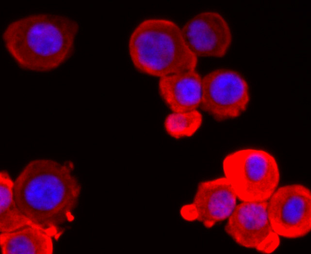 PGP9.5 Antibody in Immunocytochemistry (ICC/IF)