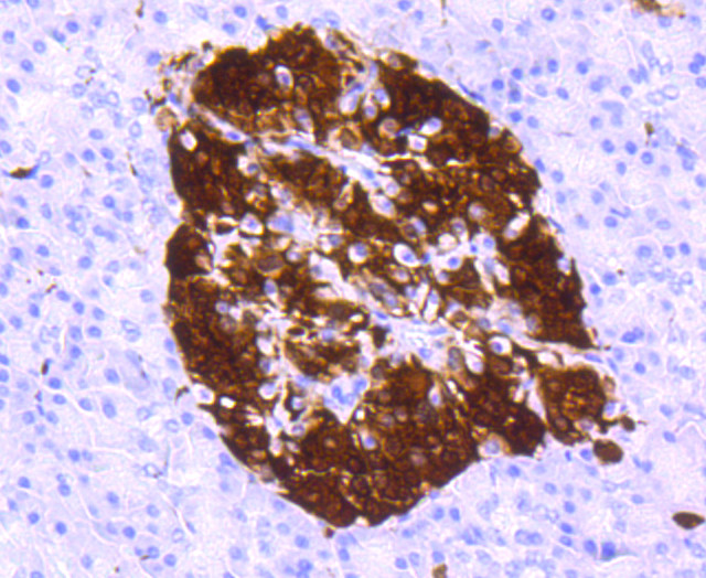 PGP9.5 Antibody in Immunohistochemistry (Paraffin) (IHC (P))