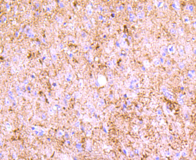 PGP9.5 Antibody in Immunohistochemistry (Paraffin) (IHC (P))