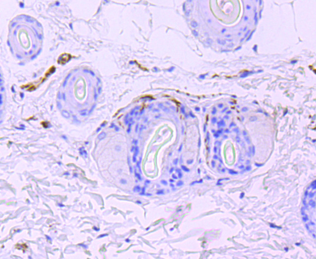 PGP9.5 Antibody in Immunohistochemistry (Paraffin) (IHC (P))