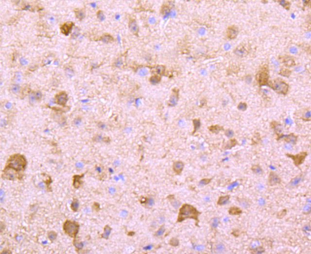 PGP9.5 Antibody in Immunohistochemistry (Paraffin) (IHC (P))