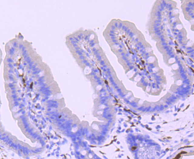 PGP9.5 Antibody in Immunohistochemistry (Paraffin) (IHC (P))