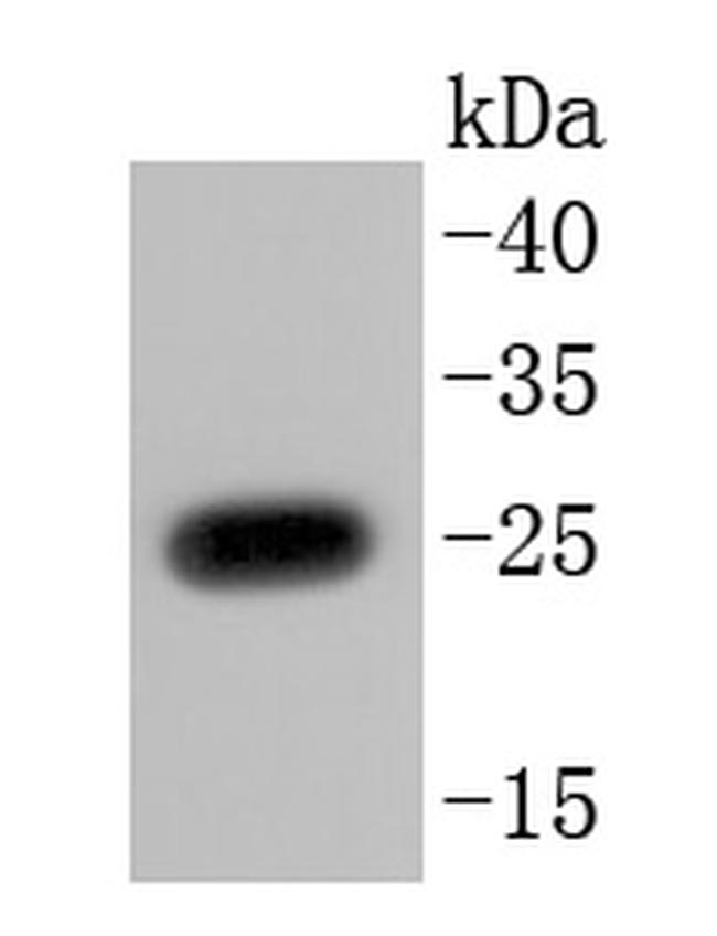 PGP9.5 Antibody in Western Blot (WB)