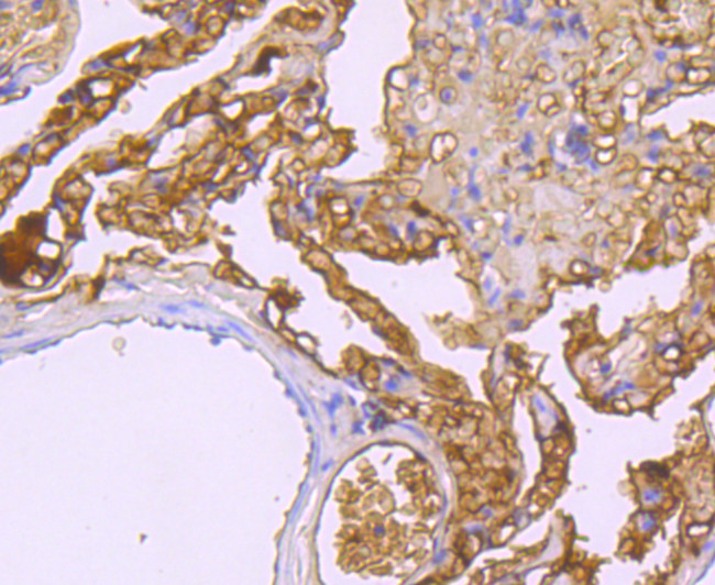 Haptoglobin Antibody in Immunohistochemistry (Paraffin) (IHC (P))