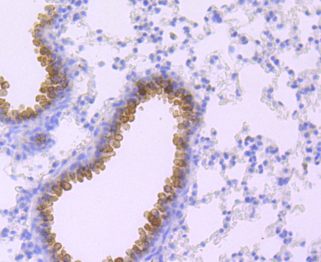 Haptoglobin Antibody in Immunohistochemistry (Paraffin) (IHC (P))