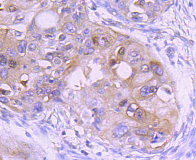 Ezrin Antibody in Immunohistochemistry (Paraffin) (IHC (P))