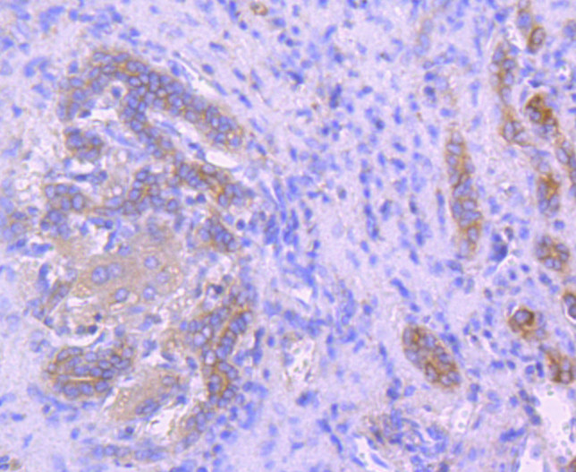 Ezrin Antibody in Immunohistochemistry (Paraffin) (IHC (P))