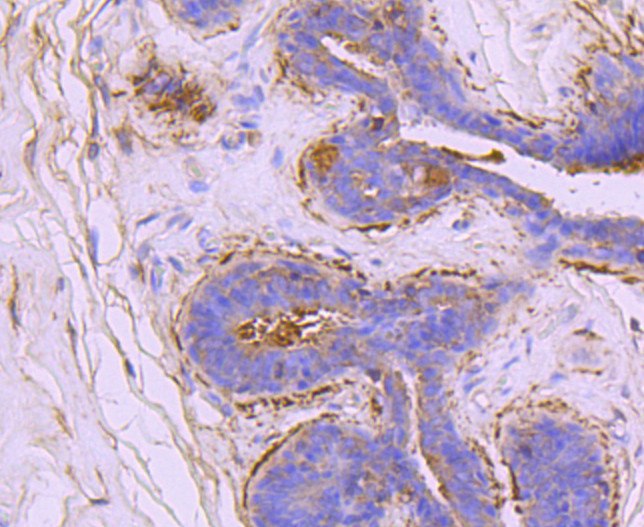 Ezrin Antibody in Immunohistochemistry (Paraffin) (IHC (P))