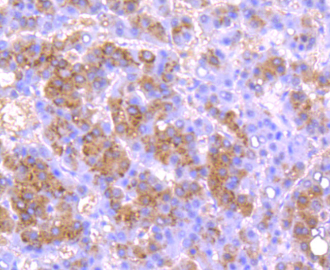 Urokinase Antibody in Immunohistochemistry (Paraffin) (IHC (P))