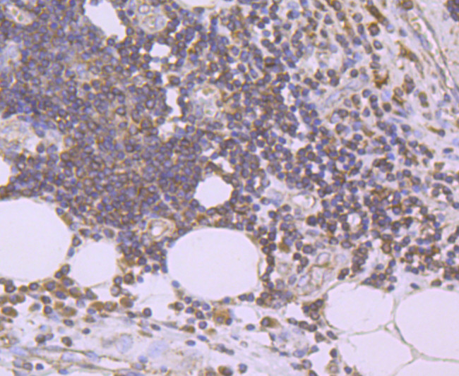 Urokinase Antibody in Immunohistochemistry (Paraffin) (IHC (P))