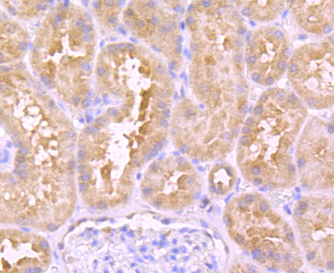 Urokinase Antibody in Immunohistochemistry (Paraffin) (IHC (P))