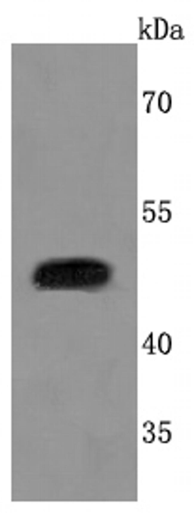 Urokinase Antibody in Western Blot (WB)