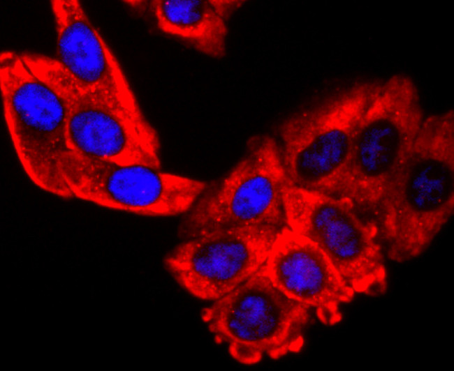 S1P1 Antibody in Immunocytochemistry (ICC/IF)