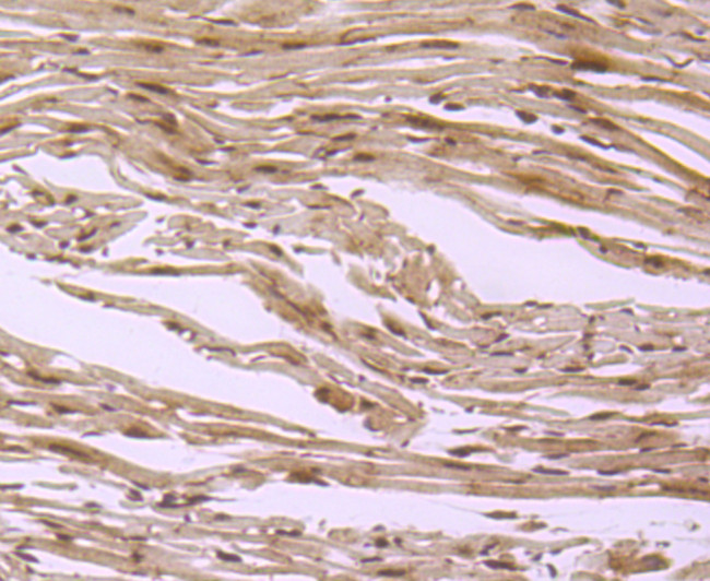 S1P1 Antibody in Immunohistochemistry (Paraffin) (IHC (P))