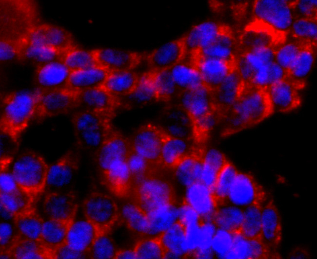 ATP Synthase beta Antibody in Immunocytochemistry (ICC/IF)