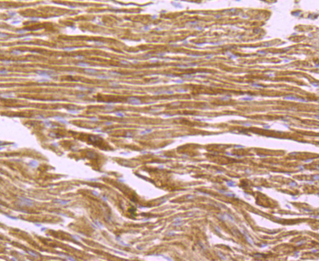 ATP Synthase beta Antibody in Immunohistochemistry (Paraffin) (IHC (P))