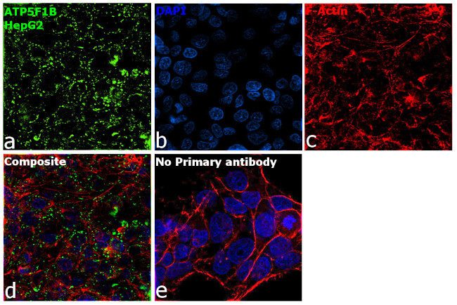 ATP Synthase beta Antibody in Immunocytochemistry (ICC/IF)