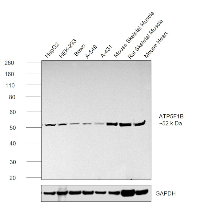 ATP Synthase beta Antibody in Western Blot (WB)