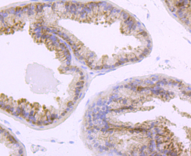 TLR5 Antibody in Immunohistochemistry (Paraffin) (IHC (P))