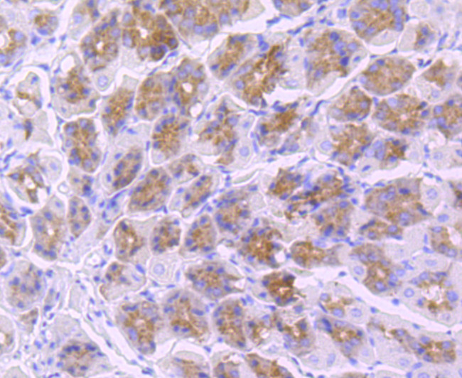 TLR5 Antibody in Immunohistochemistry (Paraffin) (IHC (P))